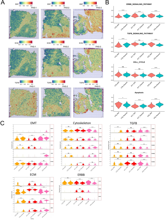 EMT/ECM通路在EVT与SMC交界的富集
