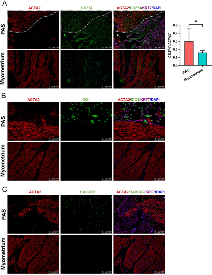 CD274/IDO1在PAS肌层的表达