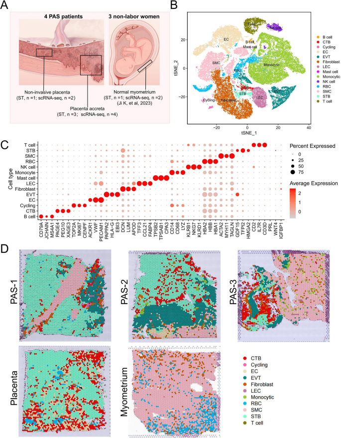 PAS侵袭组织的细胞类型空间分布