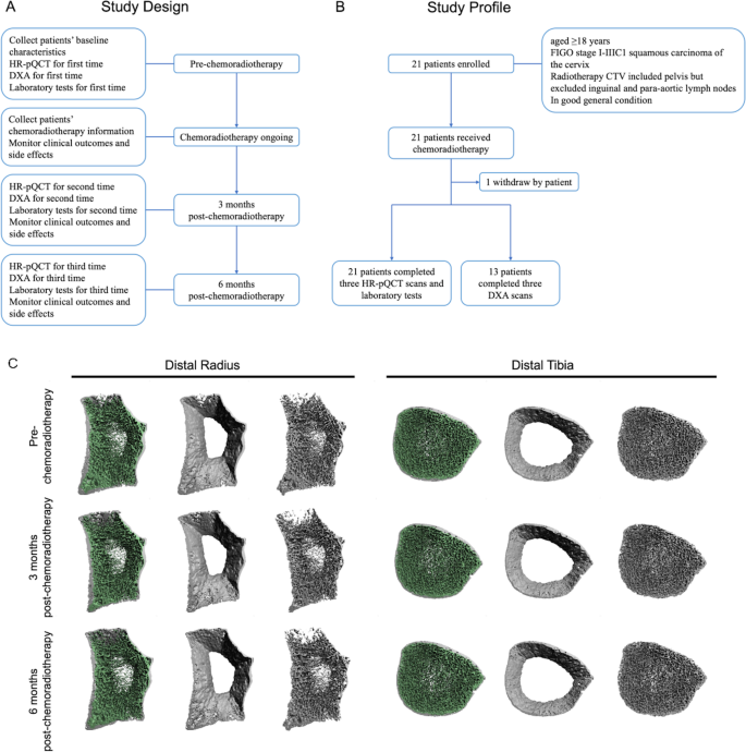 研究设计流程图与骨微结构代表性图像