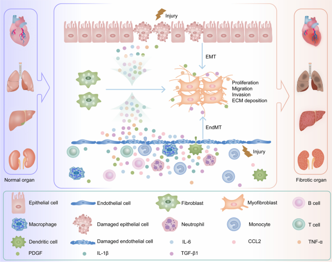 器官纤维化机制图