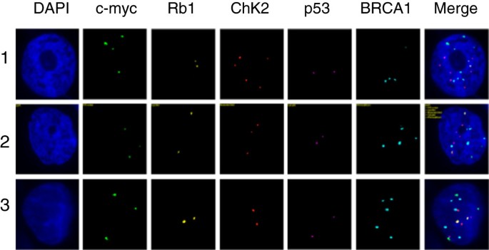 卵巢癌腹水细胞亚克隆的QM-FISH结果