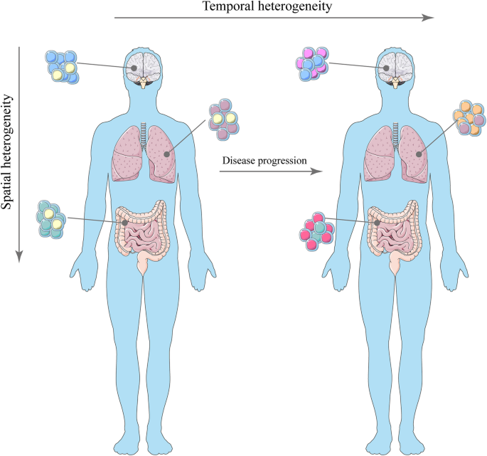 肿瘤异质性的分类
