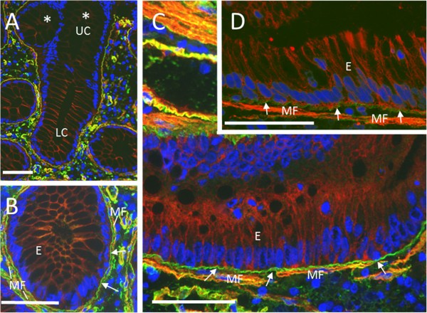图2 免疫荧光显示α1与层粘连蛋白共定位