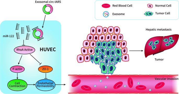 circ-IARS促进胰腺癌转移的机制