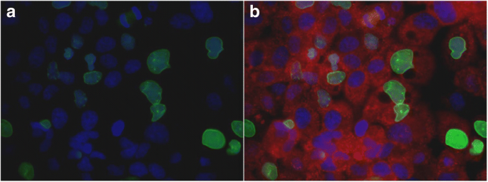 免疫荧光显示OVCAR3细胞中caspase-6定位于细胞质、lamin A丢失