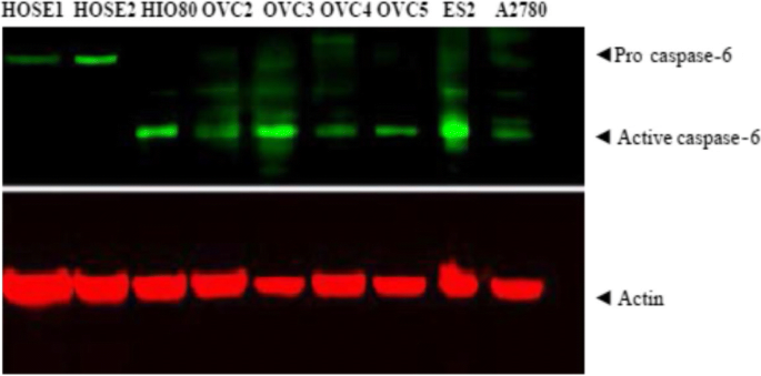 正常、永生化及癌细胞中caspase-6与lamin A/C表达差异