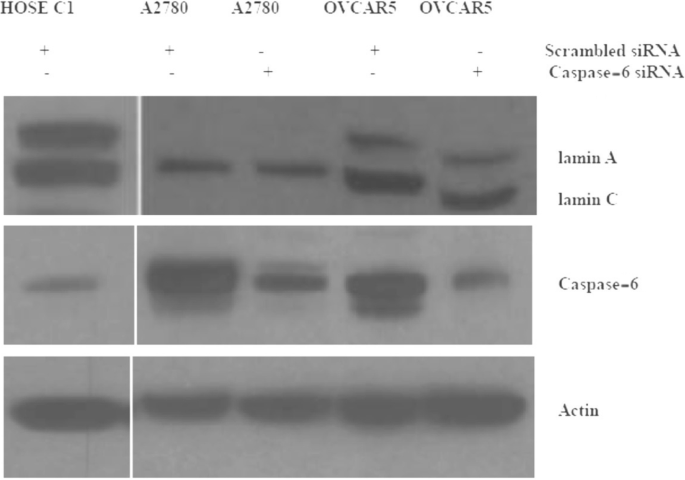 siRNA抑制caspase-6后lamin A未恢复