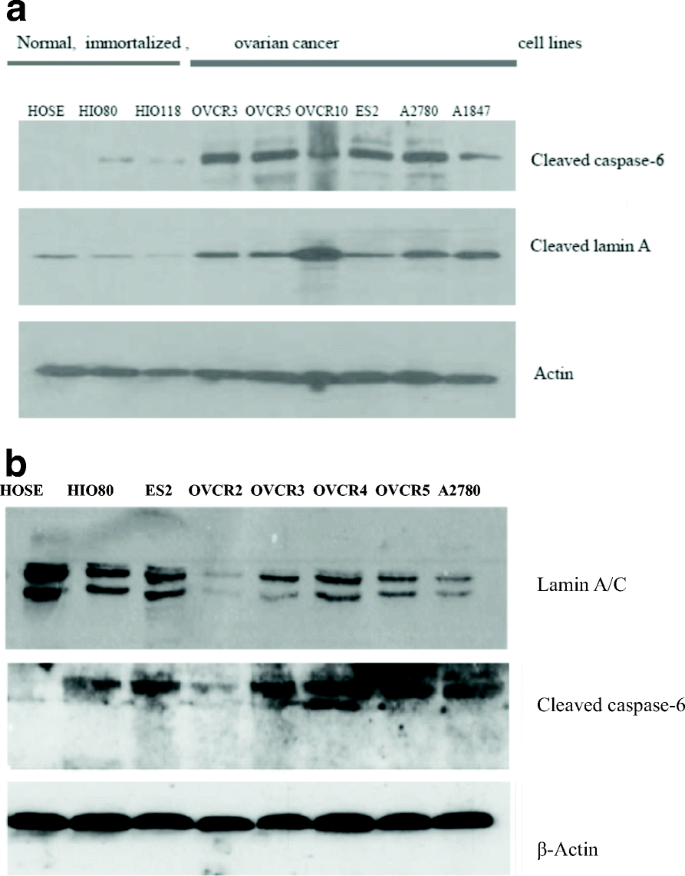 Western blot显示癌细胞中caspase-6升高、lamin A/C降低
