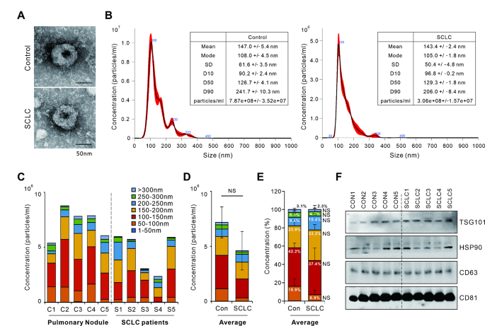图1 血清外泌体的鉴定结果
