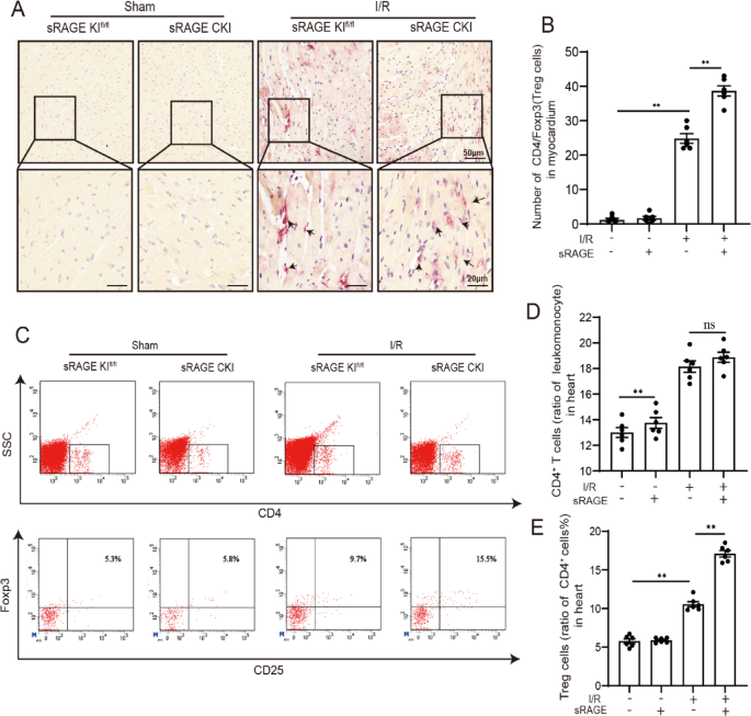 sRAGE通过调节调节性T细胞抑制心肌缺血再灌注损伤-文献解析