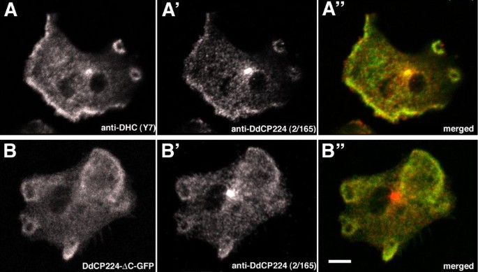 图6：DdCP224与动力蛋白的皮层共定位