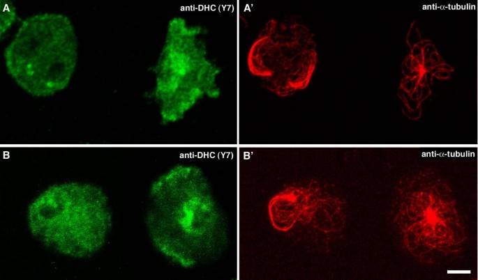 图4：微管坍塌细胞的皮层动力蛋白减少