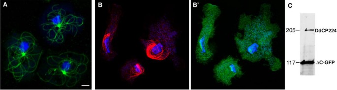 图1：DdCP224-ΔC-GFP过表达导致间期微管阵列坍塌