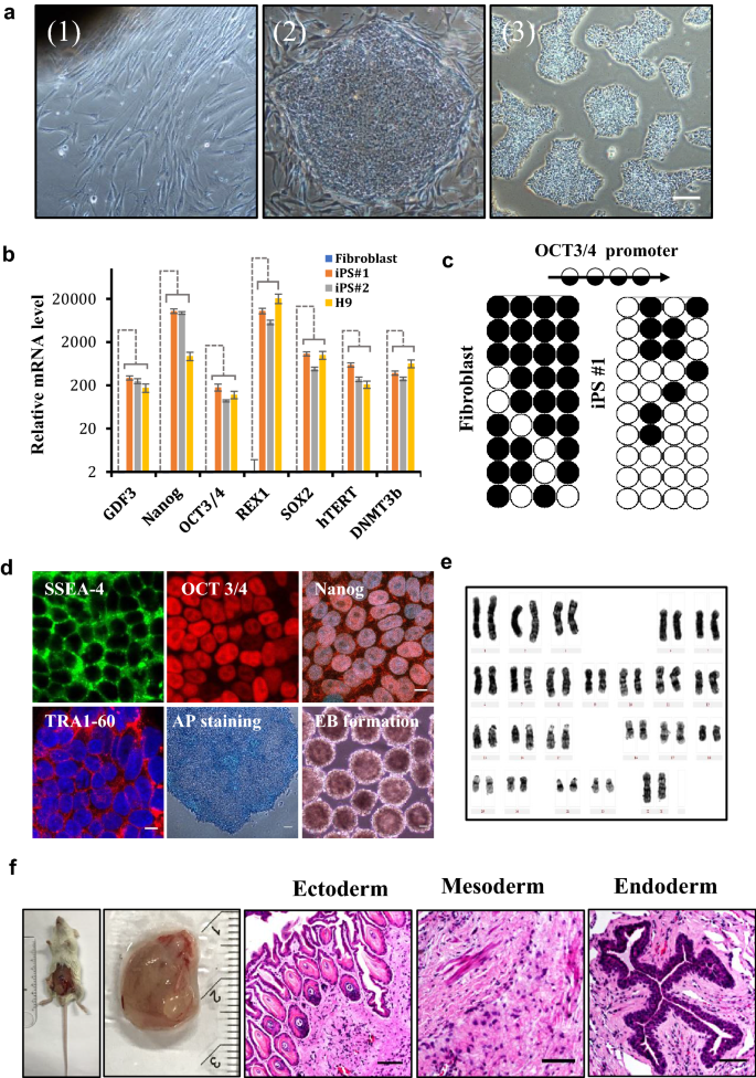 图1：无整合iPSC的多能性验证