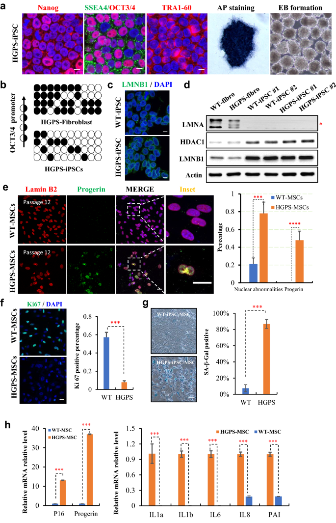 图4：HGPS-MSCs的早老表型