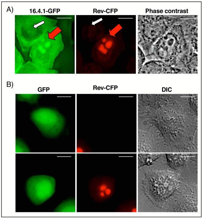 图7 Rev与16.4.1的核仁共定位