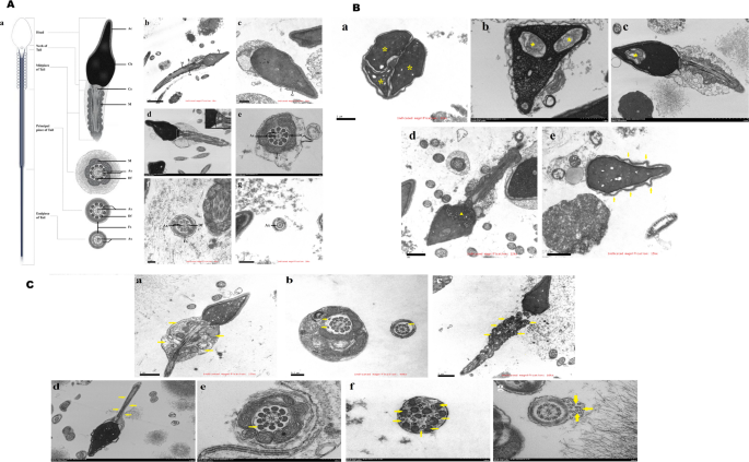 图1：正常与异常精子的超微结构