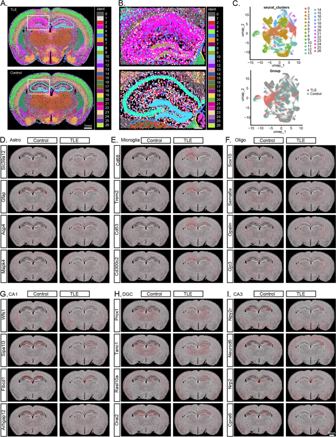 figure 6 Xenium空间转录组学分析
