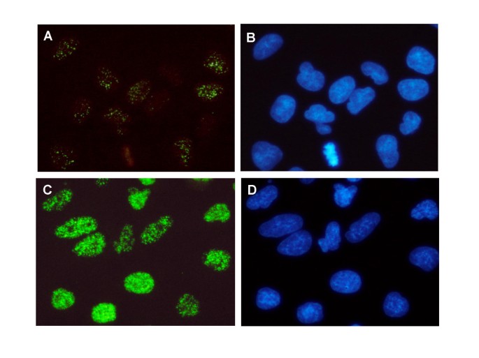 图8 烟草烟雾暴露后γH2AX的亚细胞定位