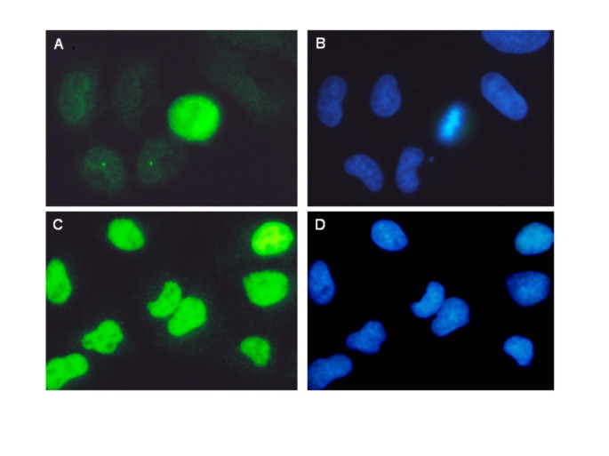 图7 烟草烟雾暴露后ATM-S1981P的亚细胞定位