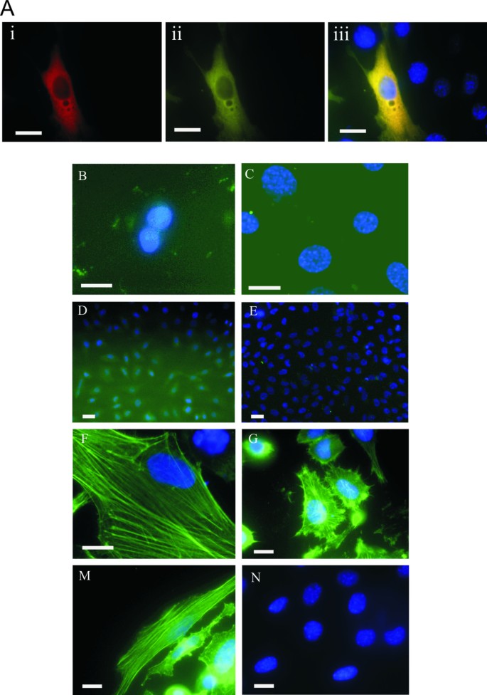 BiFC验证复合物定位