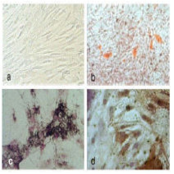 间充质干细胞形态及分化染色：a)常规培养的骨髓间充质干细胞（贴壁、长梭形）；b)油红O染色显示脂肪细胞内脂肪积累；c&d)Von Kossa和碱性磷酸酶染色显示间充质干细胞向骨细胞分化