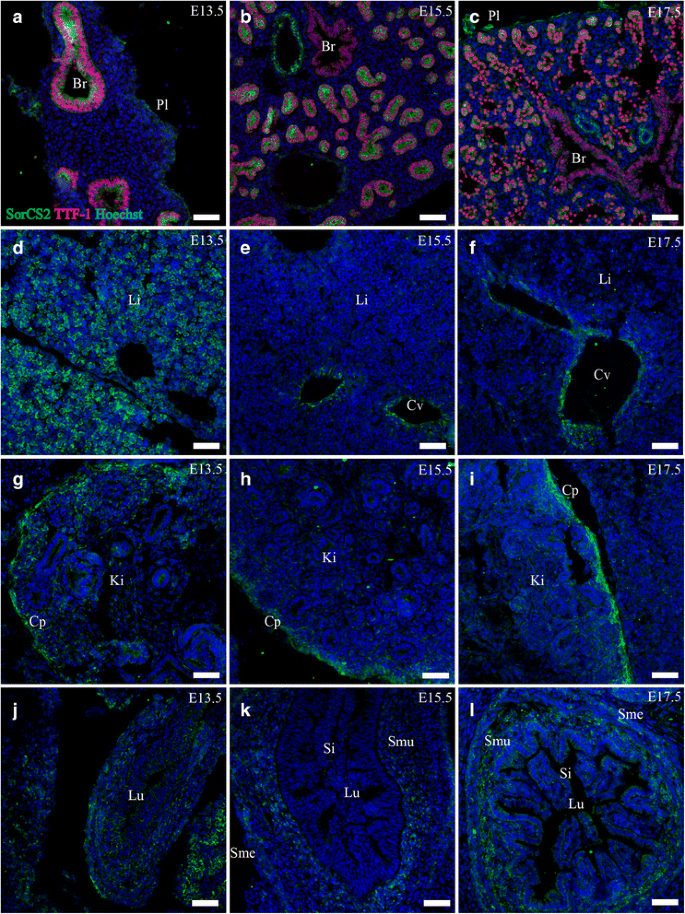 SorCS2在内部器官的表达