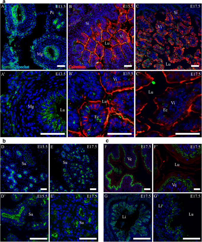 sortilin在消化系统的表达