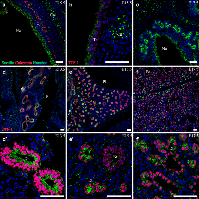 器官发育过程中sortilin和SorCS2的时空定位模式-文献解析