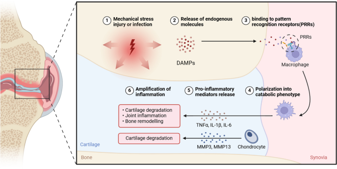 先天免疫系统在骨关节炎发病中的作用