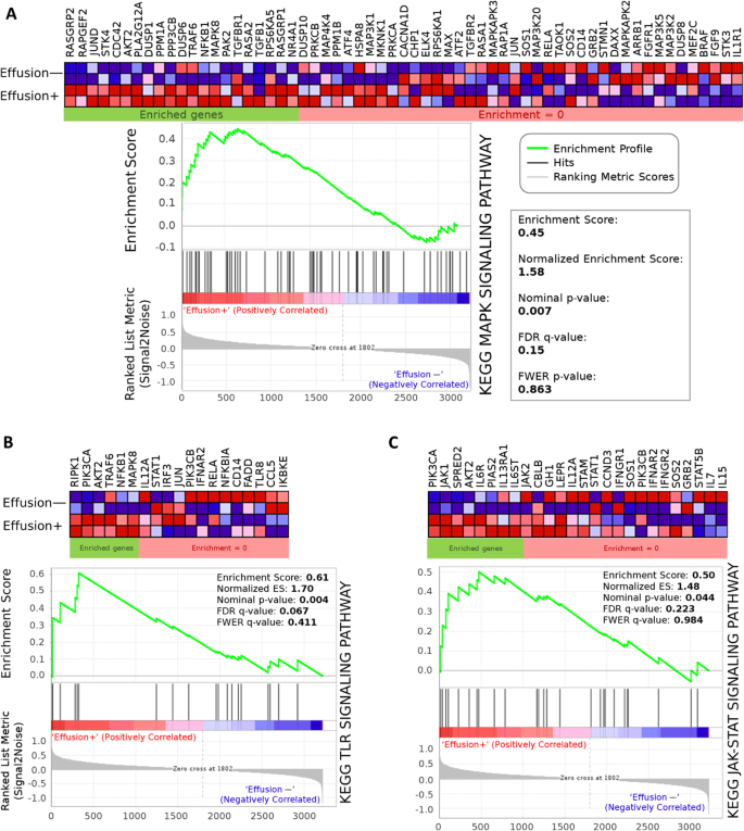 图3 GSEA分析显示伴积液DLBCL样本中激活的通路