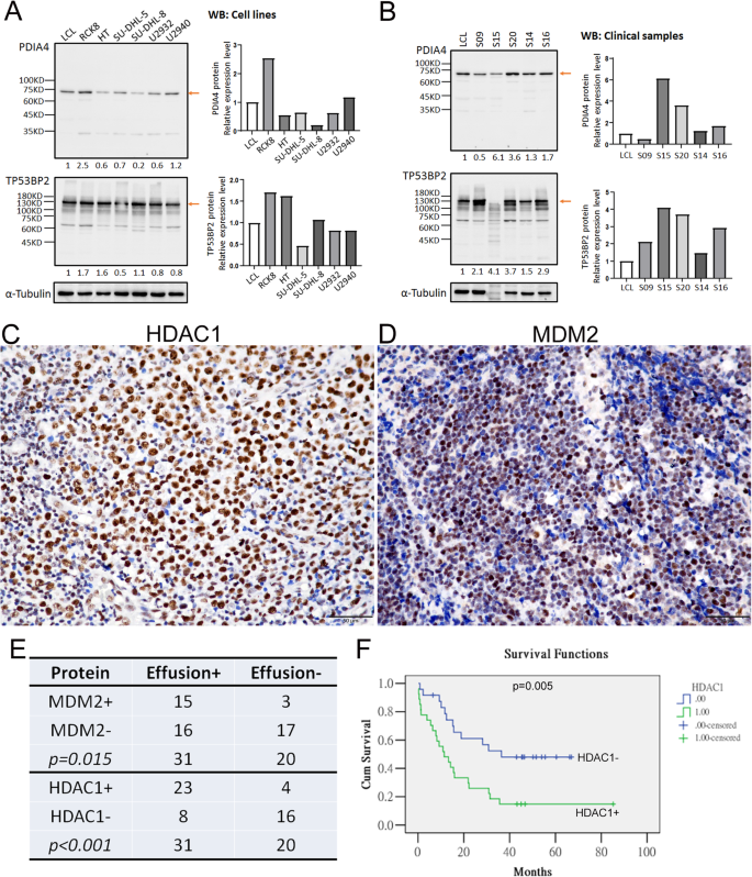 图6 IHC验证HDAC1、MDM2表达及生存分析