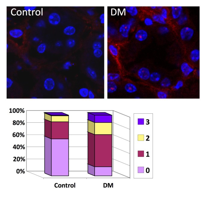 图7 糖尿病小鼠肾脏组织的γ-H2AX染色
