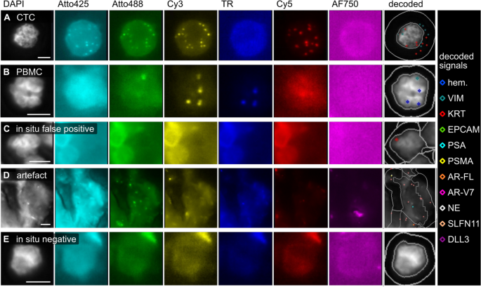数据集细胞分类示例