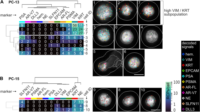 PC-13和PC-15患者CTCs聚类分析