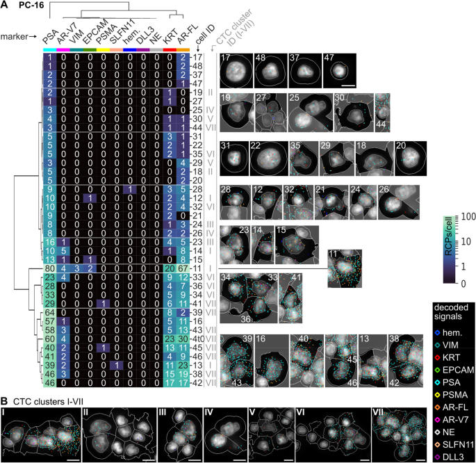 PC-16患者CTCs聚类分析