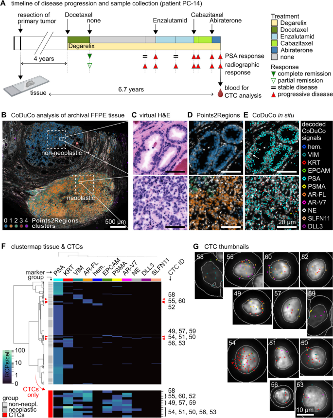 匹配CTCs与FFPE组织样本分析