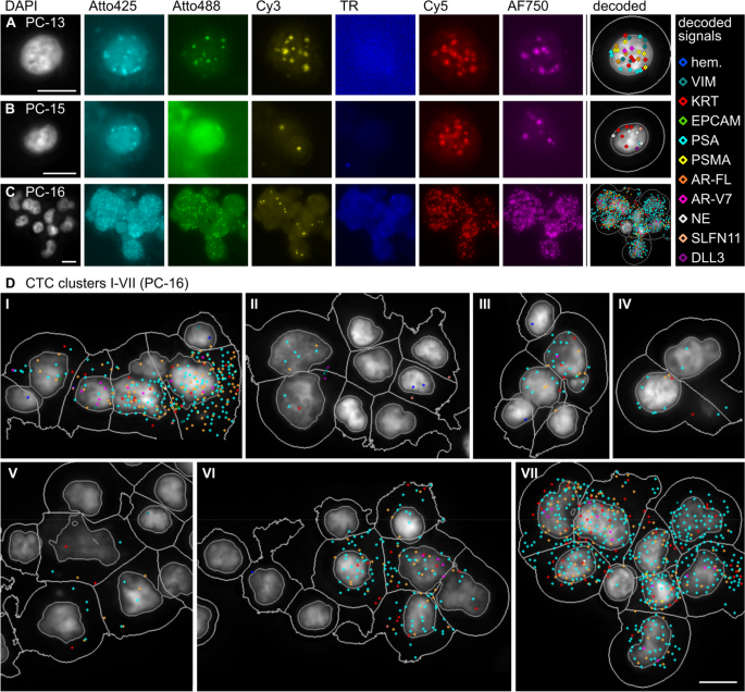 患者CTCs示例图像