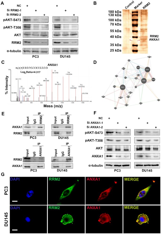 RRM2与ANXA1的相互作用验证