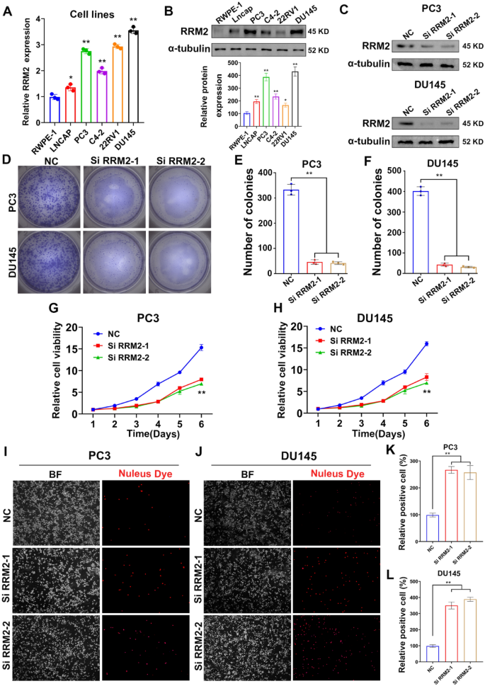 RRM2对前列腺癌细胞增殖凋亡的调控