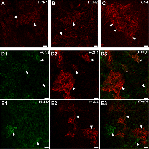 图3:HL-1细胞中HCN通道亚型的蛋白表达