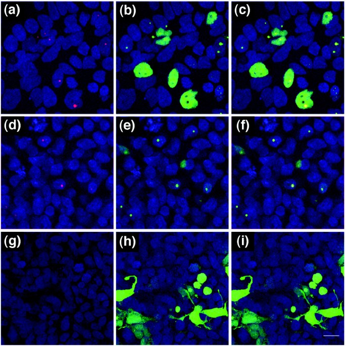 HEK293细胞中STI1核定位