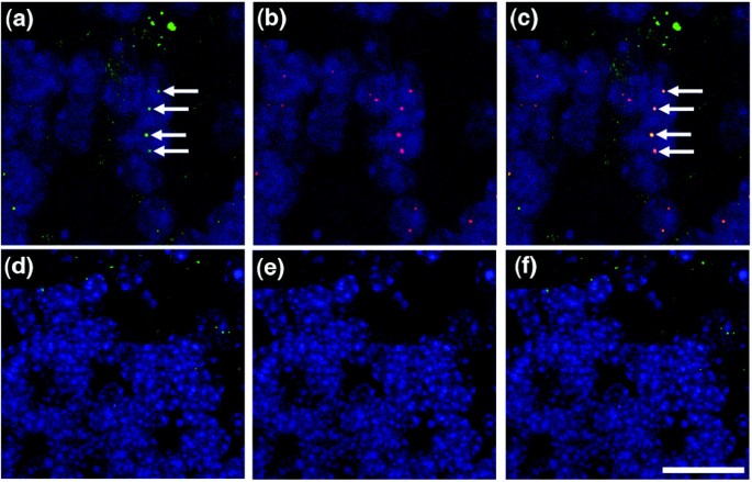 Wld^s小鼠小脑VCP核定位