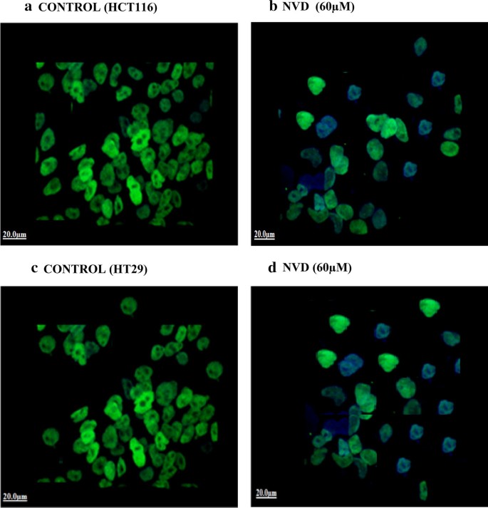 NVD对β-catenin细胞内定位的影响