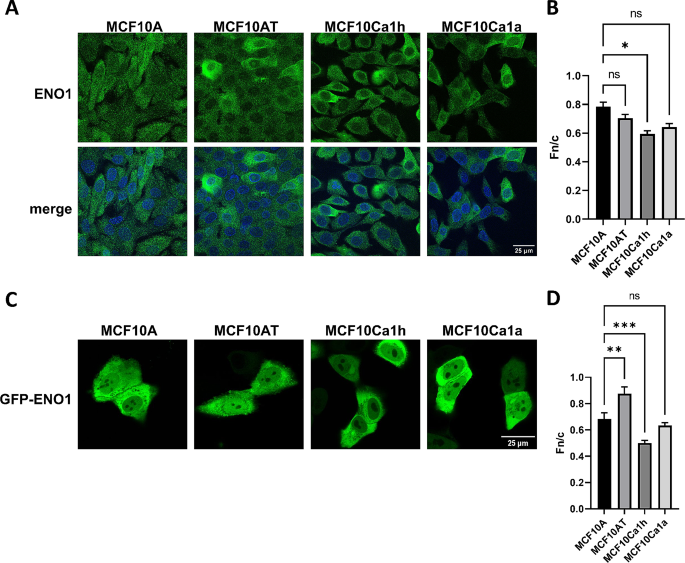 GFP-ENO1亚细胞定位分析