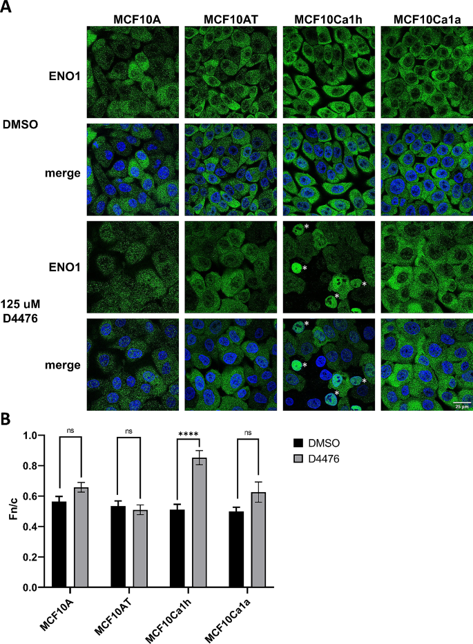 CK1抑制剂对ENO1定位的调控