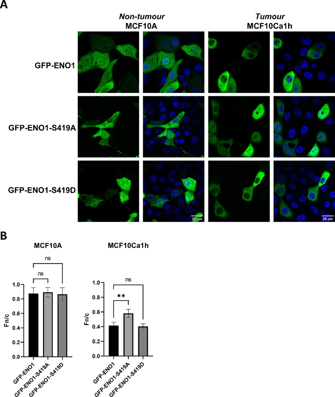 S419突变体对ENO1定位的影响