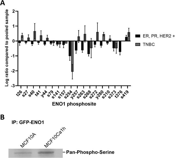ENO1 S419磷酸化位点筛选与验证