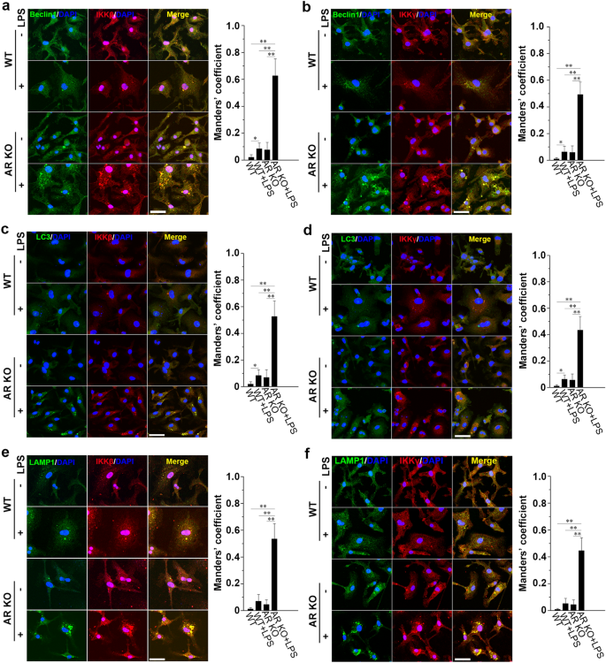 图5 AR缺失促进IKK复合物与自噬体、溶酶体的共定位